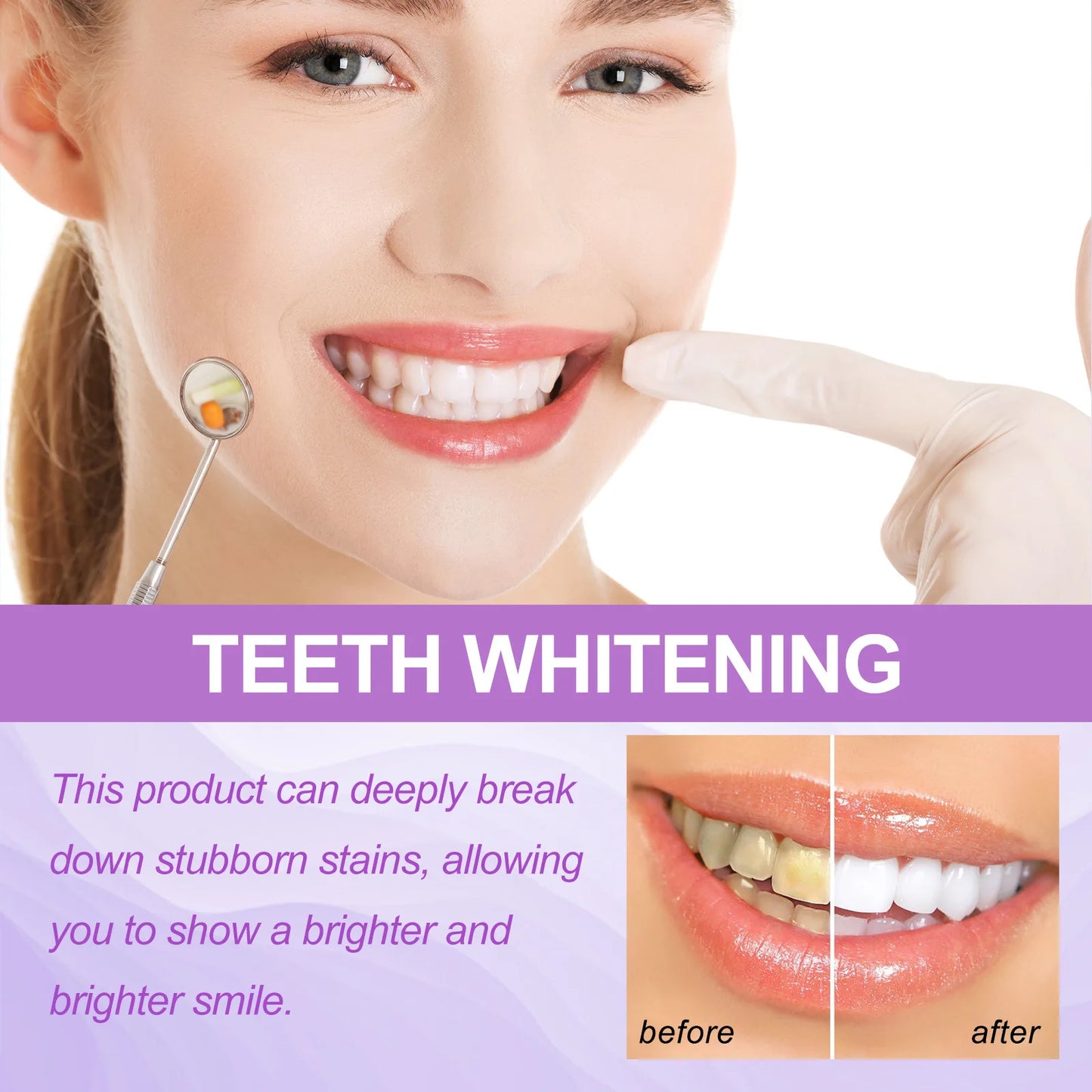 Jaysuing Whitening Strips